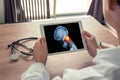 Doctor holding a digital tablet with x-ray of skull head and pain in the top of the neck. Migraine and headache concept