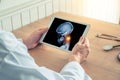 Doctor holding a digital tablet with x-ray of skull. Pain on the neck. Migraine headache or trauma concept