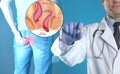 Doctor holding suppository near man suffering from hemorrhoid pain. Unhealthy lower rectum