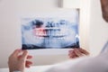 Doctor Holding Teeth X-ray Royalty Free Stock Photo