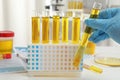 Doctor holding test tube with urine sample for analysis in laboratory Royalty Free Stock Photo