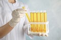 Doctor holding test tubes with urine samples for analysis on light blue background Royalty Free Stock Photo