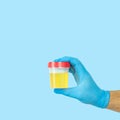 Doctor holding urine sample container for urinalysis Royalty Free Stock Photo