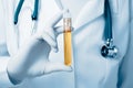 Doctor holding urine sample Royalty Free Stock Photo