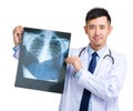 Doctor holding X-ray Royalty Free Stock Photo