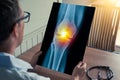 Doctor holding a x-ray of leg with pain on the knee in medical office. Front view Royalty Free Stock Photo