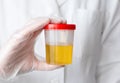 The doctor holds a can of urine analysis in his hand. Urine sample for exam. Selective focus Royalty Free Stock Photo