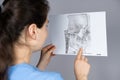 The doctor holds a CT scan of a patient with temporomandibular joint dysfunction and malocclusion.