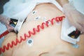 Application Defibrillator on CPR training Royalty Free Stock Photo