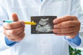 Doctor holds before itself and shows patient printed picture with ultrasound examination of gallbladder, pointing with a pen on ga