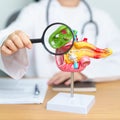 Doctor with human Pancreatitis anatomy model with Pancreas, Gallbladder, Bile Duct, Duodenum, Small intestine and magnifying glass Royalty Free Stock Photo