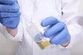 A doctor, lab technician in blue gloves holding urine sample in a plastic container, urinalysis and filling the pipette Royalty Free Stock Photo