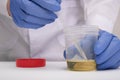 A doctor, lab technician in blue gloves holding urine sample in a plastic container, urinalysis and filling the pipette with urine Royalty Free Stock Photo