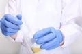 A doctor, lab technician in blue gloves holding urine sample in a plastic container, urinalysis and filling the pipette
