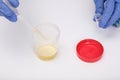 A doctor, lab technician in blue gloves holding urine sample in a plastic container, urinalysis and filling the pipette with urine Royalty Free Stock Photo