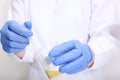 A doctor, lab technician in blue gloves holding urine sample in a plastic container, urinalysis and filling the pipette with urine