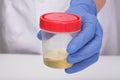 A doctor, lab technician in blue gloves holding urine sample in a plastic container, urinalysis on white background, medical check Royalty Free Stock Photo