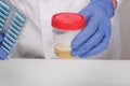 A doctor, lab technician in blue gloves holding urine sample in a plastic container, urinalysis on white background Royalty Free Stock Photo