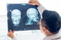 Doctor looking at film x-ray of patient head planning for surgery