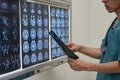 Doctor looking at MRI film of human brain Royalty Free Stock Photo