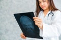 Doctor looking at patient xray film of head injury Royalty Free Stock Photo