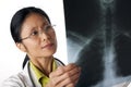 Doctor Looking at X-Ray Royalty Free Stock Photo
