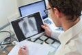 Doctor looking at x-ray of lungs, cancer diagnosis Royalty Free Stock Photo