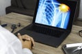 Doctor looking a x-ray of pain in the shoulder on a laptop.