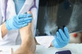 Doctor looking at xray of foot and examining patient leg closeup Royalty Free Stock Photo