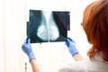 The doctor looks at the x-ray of the female mammary glands