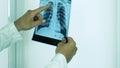 Look at the X-ray of a person`s lungs,the doctor diagnoses a patient,pneumonia of the lungs,coronavirus disease,close-up