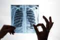The doctor looks at the x-ray of the patient's lungs and shows the ok sign. Royalty Free Stock Photo