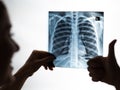 Doctor looks at x-ray of patient's lungs and shows thumb up. Royalty Free Stock Photo