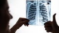 Doctor looks at x-ray of patient's lungs and shows thumb up. Royalty Free Stock Photo