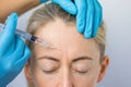 Doctor makes the rejuvenating facial injections for smoothing woman`s forehead skin