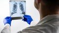 The doctor makes an x-ray analysis of the lungs of a picture on a white background,a medical worker holds an x-ray in his hands an Royalty Free Stock Photo