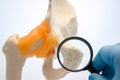 Doctor or medical student looks at pubic bone namely pubic symphysis through magnifying glass with selective focus on increase sur