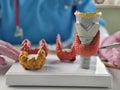 Doctor with model of human thyroid anatomy. Hyperthyroidism and cancer concept Royalty Free Stock Photo