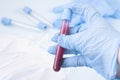 Doctor or nurse holds a test tube to send to the laboratory for blood analysis. hands of a laboratory assistant with a test tube f