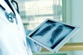 Doctor observing a chest radiograph in a tablet