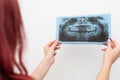 Dentist doctor checking dental x-ray orthopantomogram. Dental panoramic radiography Royalty Free Stock Photo