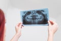 Doctor orthodontist analyzes the orthopantomogram of the patient`s jaws to diagnose