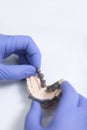 Doctor orthodontist holds the braces in his hands before installing the patient. Unrecognizable person. Hands in protective gloves