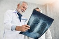 Doctor and patient are examining x-ray film. Royalty Free Stock Photo