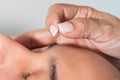 Doctor performing facial acupuncture on a male patient