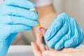 Doctor piercing patients finger with lancet in clinic closeup. Taking blood for close-up analysis, a clinical blood test