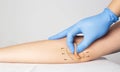 Doctor plastic surgeon examines the skin on the patient`s elbow. The concept of plastic surgery and skin tightening on the hands, Royalty Free Stock Photo