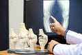 Doctor pointing on the knee problem point on x-ray film. x-ray film show skeleton knee on film. Royalty Free Stock Photo