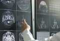 Doctor pointing to brain anatomy on MRI image Royalty Free Stock Photo