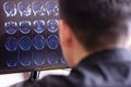 Doctor radiologist in hospital looking at mri x-ray scan of brain, head and skull ct scanning image on computer screen